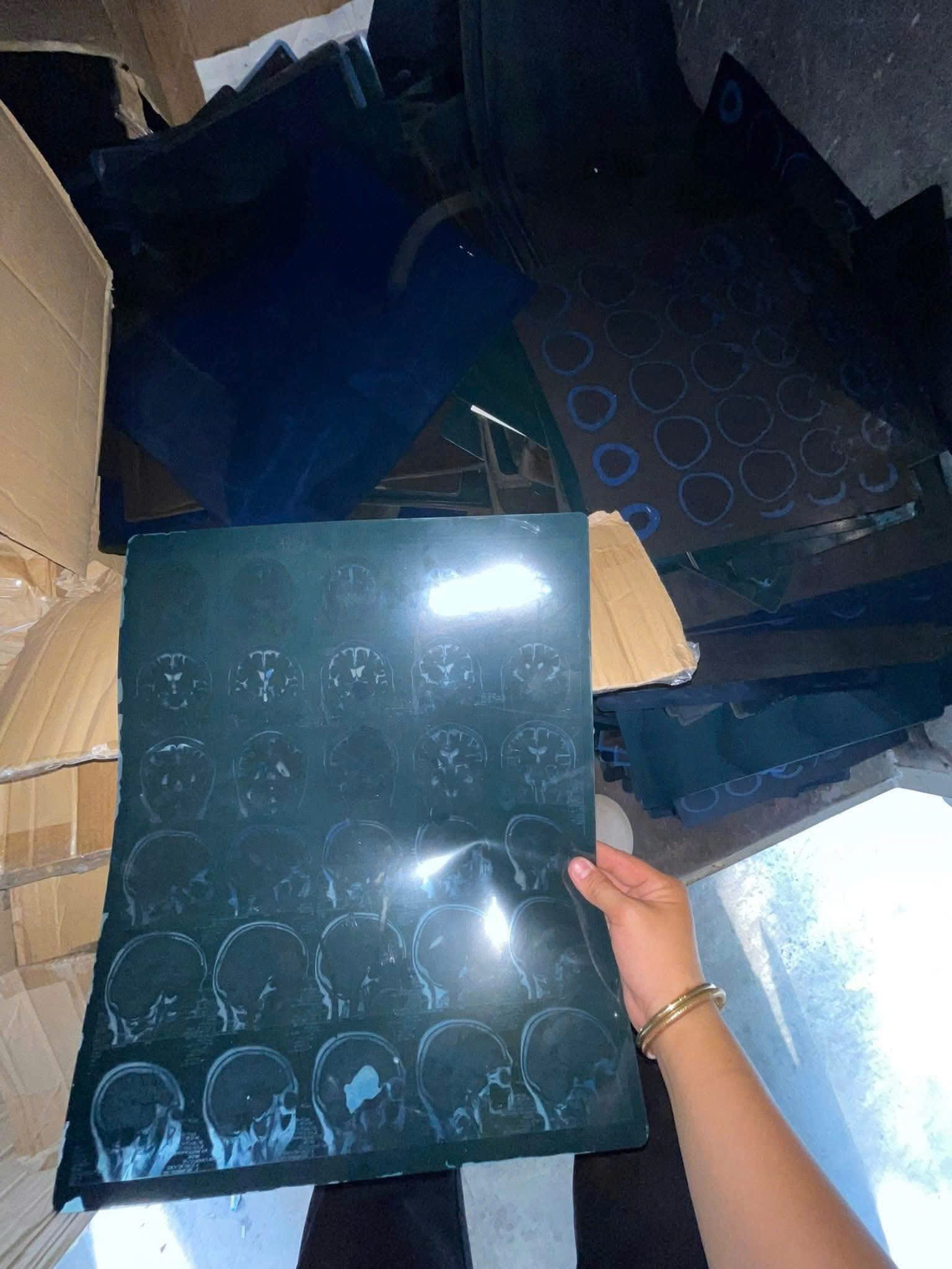 Quy trình phân loại nghiêm ngặt tại Phế Liệu Đức Tín đảm bảo phim X-quang được đưa vào tái chế đúng chuẩn y tế.